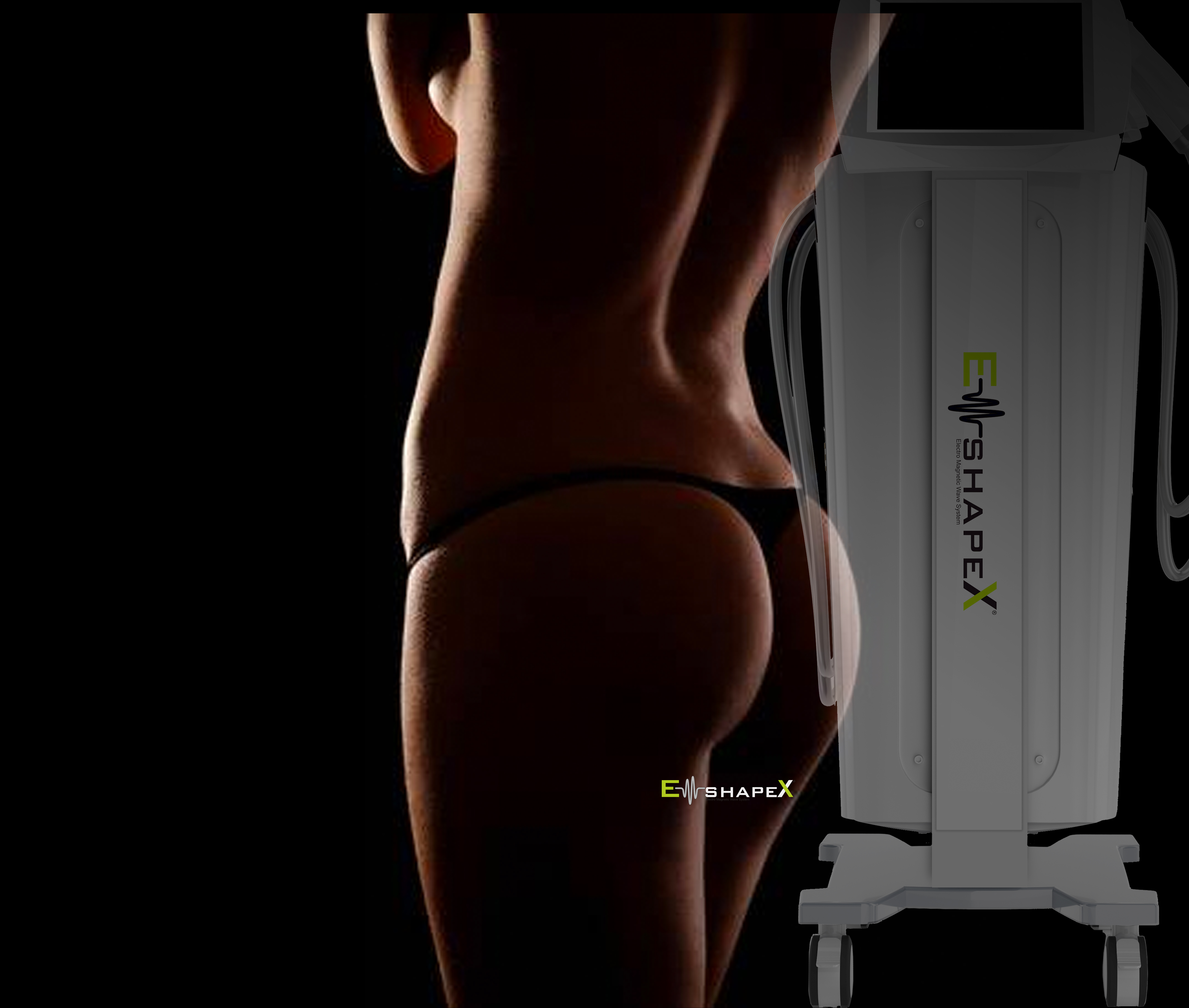 straffer Po mit EmSchapeX